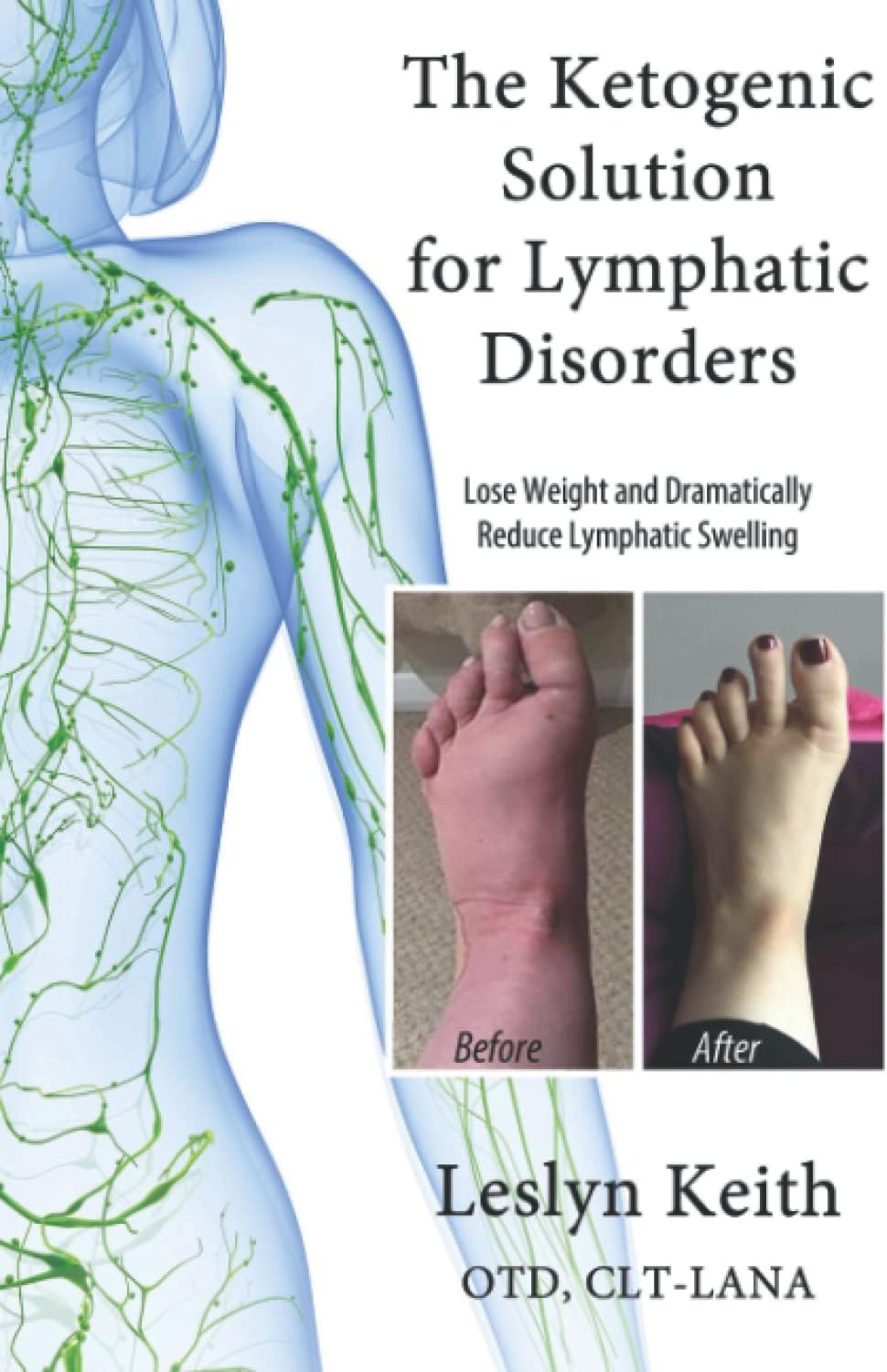 617VlVw5RhL. AC SL1500